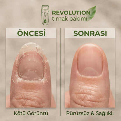 Şarjlı Tırnak Kesme -Törpüleme Aleti